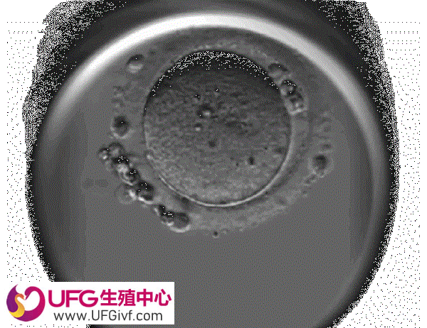 胚胎移植后熬夜影响激素改变