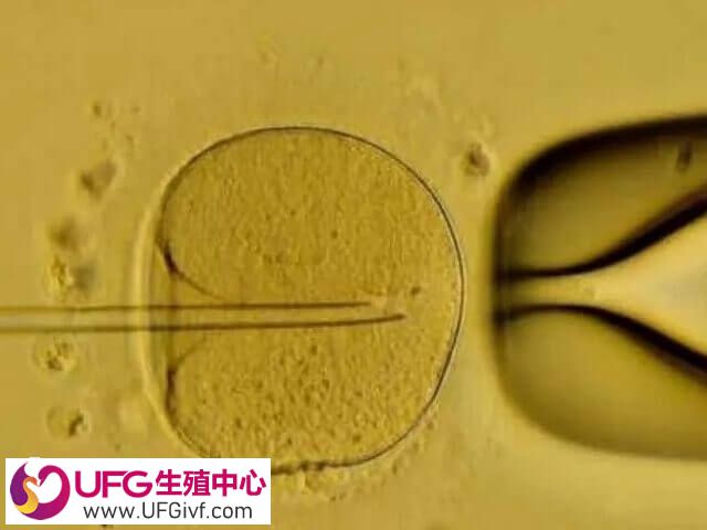 囊胚移植成功率高