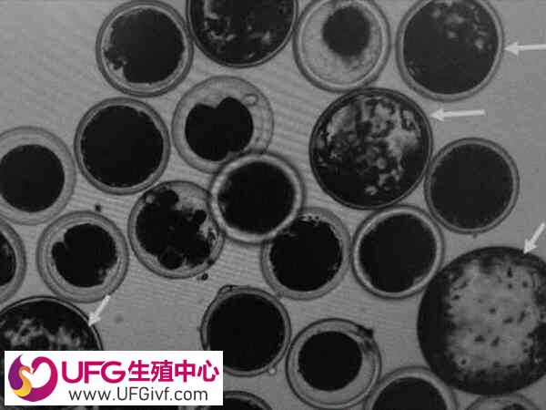 桑椹胚的存储和使用受到一定限制