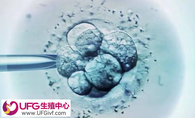 胚胎移植之后应多休息