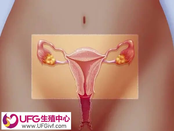 排卵前疼痛多发生于腹的一侧