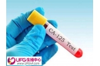 做试管婴儿前查ca125是为了判定子宫内